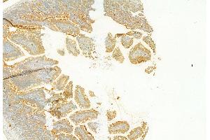 ABIN6257434 and ABIN6273695 at 1/100 staining Rat colon tissue by IHC-P. (PLCE1 抗体)
