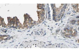 ABIN6272548 at 1/100 staining Human prostate tissue by IHC-P. (AK8 抗体  (Internal Region))