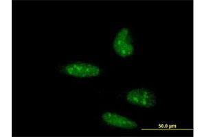 Immunofluorescence of monoclonal antibody to ATOH1 on HeLa cell. (ATOH1 抗体  (AA 266-354))