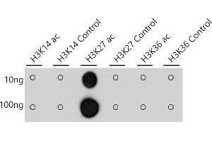 Dot-blot analysis of all sorts of peptides using Acetyl-Histone H3-K27 antibody (ABIN3016650, ABIN3016651, ABIN3016652, ABIN1682513 and ABIN1682514) at 1:1000 dilution. (Histone 3 抗体  (acLys27))