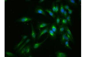 Immunofluorescent analysis of Hela cells using ABIN7152944 at dilution of 1:100 and Alexa Fluor 488-congugated AffiniPure Goat Anti-Rabbit IgG(H+L) (Filamin A 抗体  (AA 1234-1462))