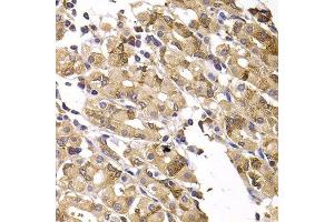 Immunohistochemistry of paraffin-embedded human gastric injury using ASMTL antibody. (ASMTL 抗体  (AA 1-290))