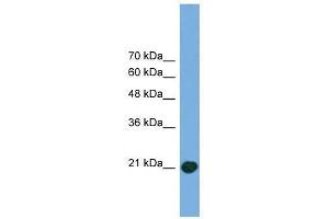 COMMD8 antibody used at 0. (COMMD8 抗体  (Middle Region))