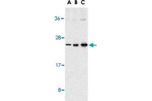Western blot analysis of TNFSF13 expression in Jurkat cells with TNFSF13 polyclonal antibody  at 1 ug/mL (A), 2 ug/mL (B), and 4 ug/mL (C). (TNFSF13 抗体  (C-Term))