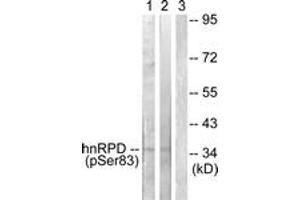 Western blot analysis of extracts from HuvEc and 293 cells, using hnRPD (Phospho-Ser83) Antibody. (HNRNPD/AUF1 抗体  (pSer83))