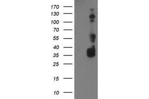 Western Blotting (WB) image for anti-BAI1-Associated Protein 2 (BAIAP2) antibody (ABIN1496805) (BAIAP2 抗体)