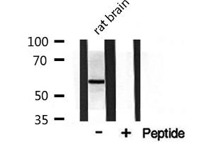Western blot analysis on rat brain lysate using DOK3 Antibody (DOK3 抗体  (Internal Region))
