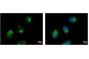 Immunofluorescence (IF) image for anti-Golgi-Associated, gamma Adaptin Ear Containing, ARF Binding Protein 3 (GGA3) (C-Term) antibody (ABIN2856386)