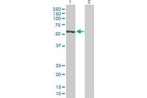 Western Blot analysis of EPB41 expression in transfected 293T cell line by EPB41 MaxPab polyclonal antibody.