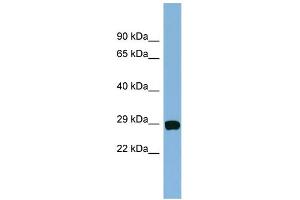 WB Suggested Anti-CHCHD3 Antibody Titration: 0. (CHCHD3 抗体  (N-Term))