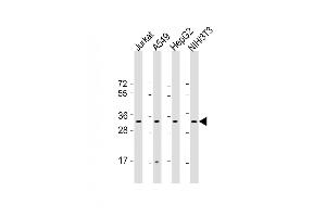 All lanes : Anti-RPS2 Antibody (C-Term) at 1:2000 dilution Lane 1: Jurkat whole cell lysate Lane 2: A549 whole cell lysate Lane 3: HepG2 whole cell lysate Lane 4: NIH/3T3 whole cell lysate Lysates/proteins at 20 μg per lane. (RPS2 抗体  (AA 248-379))