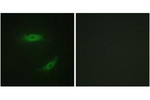 Immunofluorescence analysis of HepG2 cells, using CD4 (Phospho-Ser433) Antibody. (CD4 抗体  (pSer433))