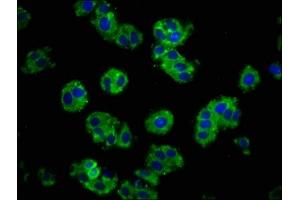 Immunofluorescence staining of HepG2 cells with ABIN7146190 at 1:100, counter-stained with DAPI. (E-cadherin 抗体  (AA 153-641))