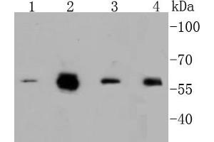 Lane 1: A549, Lane 2: HCT116, Lane 3: Hela, Lane 4: HepG2 cell lysates, probed with c-Myc(S62) (1A7 ) Monoclonal Antibody  at 1:1000 overnight at 4˚C. (c-MYC 抗体  (pSer62))