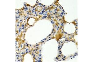 Immunohistochemistry of paraffin-embedded rat lung using IL9 antibody. (IL-9 抗体)