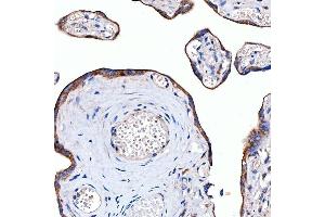 IHC analysis of Rab4/RAB4A using anti-Rab4/RAB4A antibody (ABIN7599733).