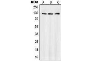 Western blot analysis of SMG7 expression in Jurkat (A), A431 (B), HeLa (C) whole cell lysates. (SMG7 抗体  (Center))