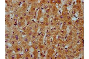 IHC image of ABIN7163112 diluted at 1:200 and staining in paraffin-embedded human liver tissue performed on a Leica BondTM system.