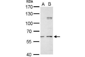 Western Blotting (WB) image for anti-Galactosamine (N-Acetyl)-6-Sulfate Sulfatase (GALNS) (Center) antibody (ABIN2856743)