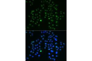 Immunofluorescence analysis of MCF7 cells using GNL3 antibody (ABIN6130343, ABIN6141249, ABIN6141250 and ABIN6222113). (Nucleostemin 抗体  (AA 1-240))