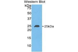 Western Blotting (WB) image for anti-NME/NM23 Nucleoside Diphosphate Kinase 6 (NME6) (AA 3-182) antibody (ABIN1860011) (NME6 抗体  (AA 3-182))