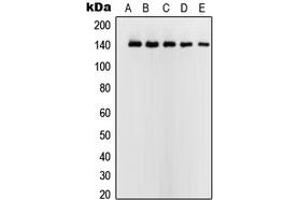 Western blot analysis of USF2 expression in HeLa (A), Jurkat (B), K562 (C), A431 (D), NIH3T3 (E) whole cell lysates. (USF2 抗体  (Center))