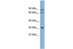 WB Suggested Anti-CUTC  Antibody Titration: 0. (CUTC 抗体  (Middle Region))