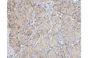 IHC analysis of COPE using anti-COPE antibody (ABIN7602509).
