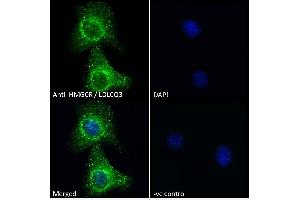 ABIN570699 Immunofluorescence analysis of paraformaldehyde fixed A549 cells, permeabilized with 0.