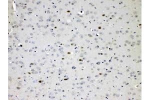 IHC analysis of CHAT using anti- CHAT antibody . (Choline Acetyltransferase 抗体  (AA 446-652))