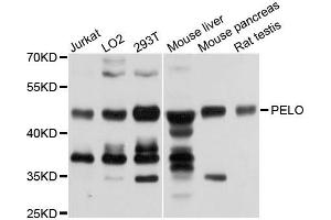 Western blot analysis of extracts of various cells, using PELO antibody. (PELO 抗体)
