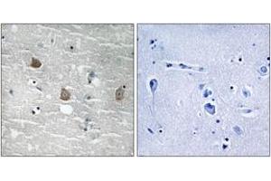 Immunohistochemistry analysis of paraffin-embedded human brain, using TOB1 (Phospho-Ser164) Antibody. (Protein Tob1 (TOB1) (AA 130-179), (pSer164) 抗体)