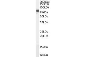 Image no. 1 for anti-Carnitine Palmitoyltransferase 1A (Liver) (CPT1A) (Internal Region) antibody (ABIN374737) (CPT1A 抗体  (Internal Region))