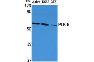 Western Blot (WB) analysis of specific cells using PLK-5 Polyclonal Antibody. (PLK5 抗体  (Internal Region))