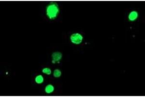 Image no. 3 for anti-T-Cell Acute Lymphocytic Leukemia 1 (TAL1) antibody (ABIN1501295)