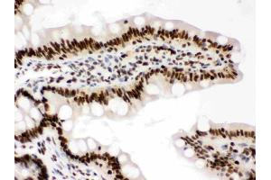 IHC analysis of RbAp48 using anti-RbAp48 antibody (ABIN3043920).