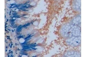 Immunohistochemistry (IHC) image for anti-POU Class 5 Homeobox 1 (POU5F1) (AA 136-360) antibody (ABIN7442423)