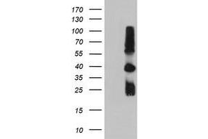 Western Blotting (WB) image for anti-Metalloproteinase Inhibitor 2 (TIMP2) antibody (ABIN1501393) (TIMP2 抗体)