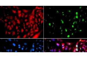 Immunofluorescence analysis of GFP-RNF168 transgenic U2OS cells using UIMC1 Polyclonal Antibody (UIMC1 抗体)