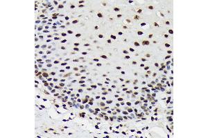 Immunohistochemistry of paraffin-embedded human esophageal using SF3B3/S Rabbit mAb (ABIN7270544) at dilution of 1:100 (40x lens). (SF3B3 抗体)