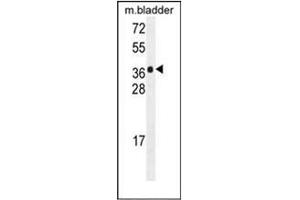 Western blot analysis of HARB1 Antibody (N-term) in mouse bladder tissue lysates (35ug/lane). (HARBI1 抗体  (N-Term))