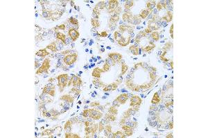 Immunohistochemistry of paraffin-embedded human stomach using IRS1 antibody (ABIN5970075) at dilution of 1/100 (40x lens).