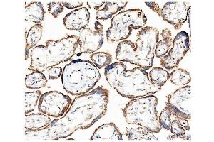IHC analysis of Hexokinase 1/HK1 using anti-Hexokinase 1/HK1 antibody (ABIN7600258). (Hexokinase 1 抗体  (AA 17-323))