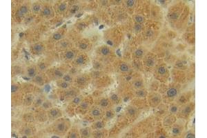 Detection of P-cadherin in Human Liver Tissue using Polyclonal Antibody to Placental Cadherin (P-cadherin) (P-Cadherin 抗体  (AA 371-660))