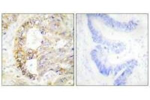 Immunohistochemistry analysis of paraffin-embedded human colon carcinoma tissue using COX41 antibody. (COX IV 抗体  (N-Term))