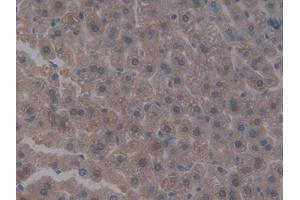 DAB staining on IHC-P; Samples: Mouse Liver Tissue (Integrin beta 5 抗体  (AA 136-378))