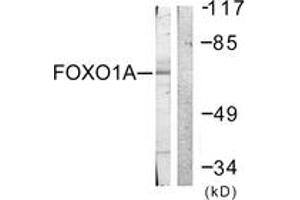Western blot analysis of extracts from HeLa cells, treated with Serum 20% 15', using FOXO1A (Ab-329) Antibody.
