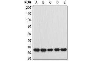 Western blot analysis of hnRNP A0 expression in MCF7 (A), SKOV3 (B), Hela (C), mouse spleen (D), mouse brain (E) whole cell lysates. (HNRNPA0 抗体)