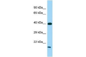 Host: Rabbit Target Name: GPR21 Sample Type: Fetal Heart lysates Antibody Dilution: 1.