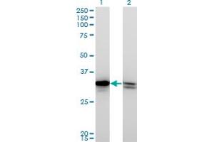 Western Blot analysis of HMGB1 expression in transfected 293T cell line by HMGB1 monoclonal antibody (M03), clone 1B11. (HMGB1 抗体  (AA 1-215))